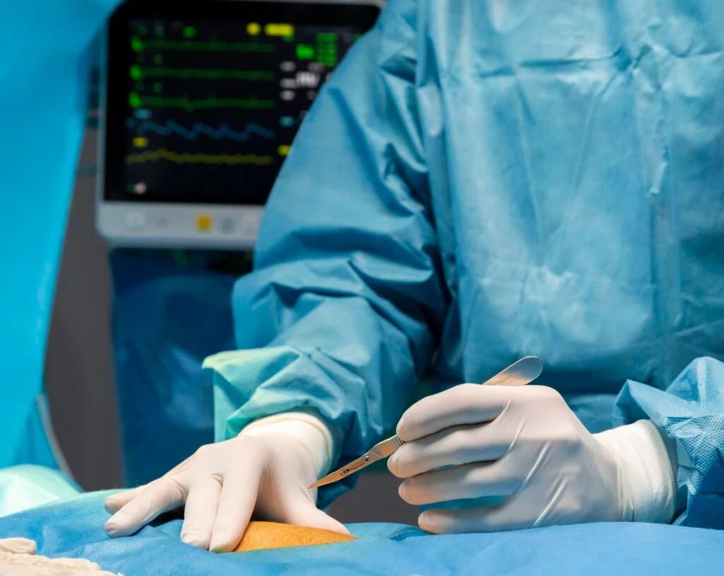 Laparoscopic Surgery Procedure, Recovery, and Key Benefits