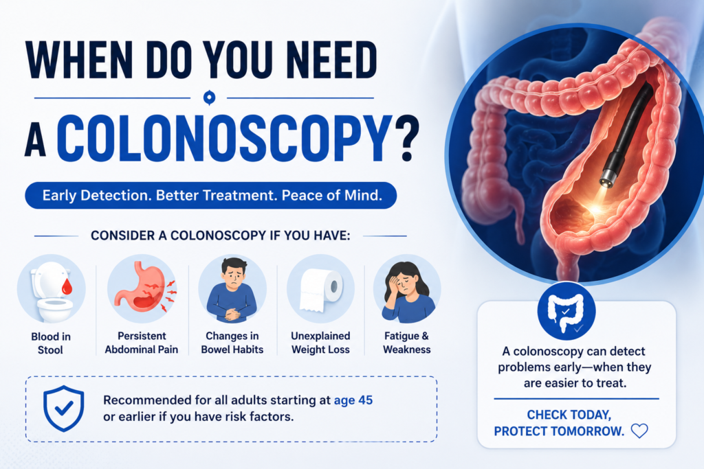 When Do You Need a Colonoscopy