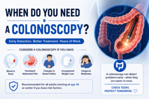 When Do You Need a Colonoscopy